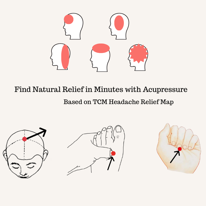 Natural Headache Relief: An Acupressure Guide to Ease Migraine, Tension, and Stress Headaches