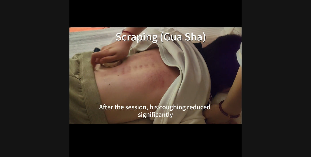 How Tuina and Gua Sha Cleared My Son's Cough