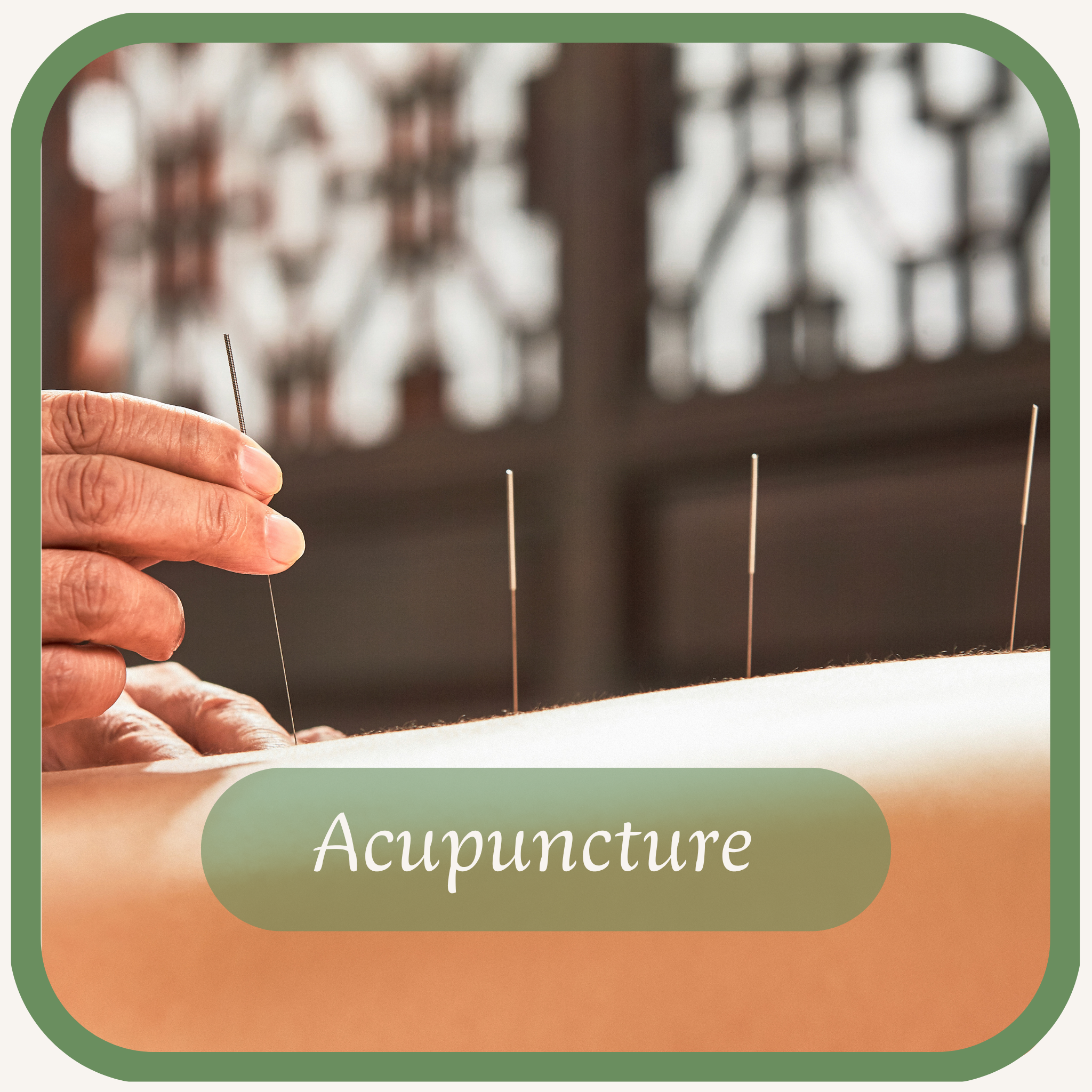 Acupuncture