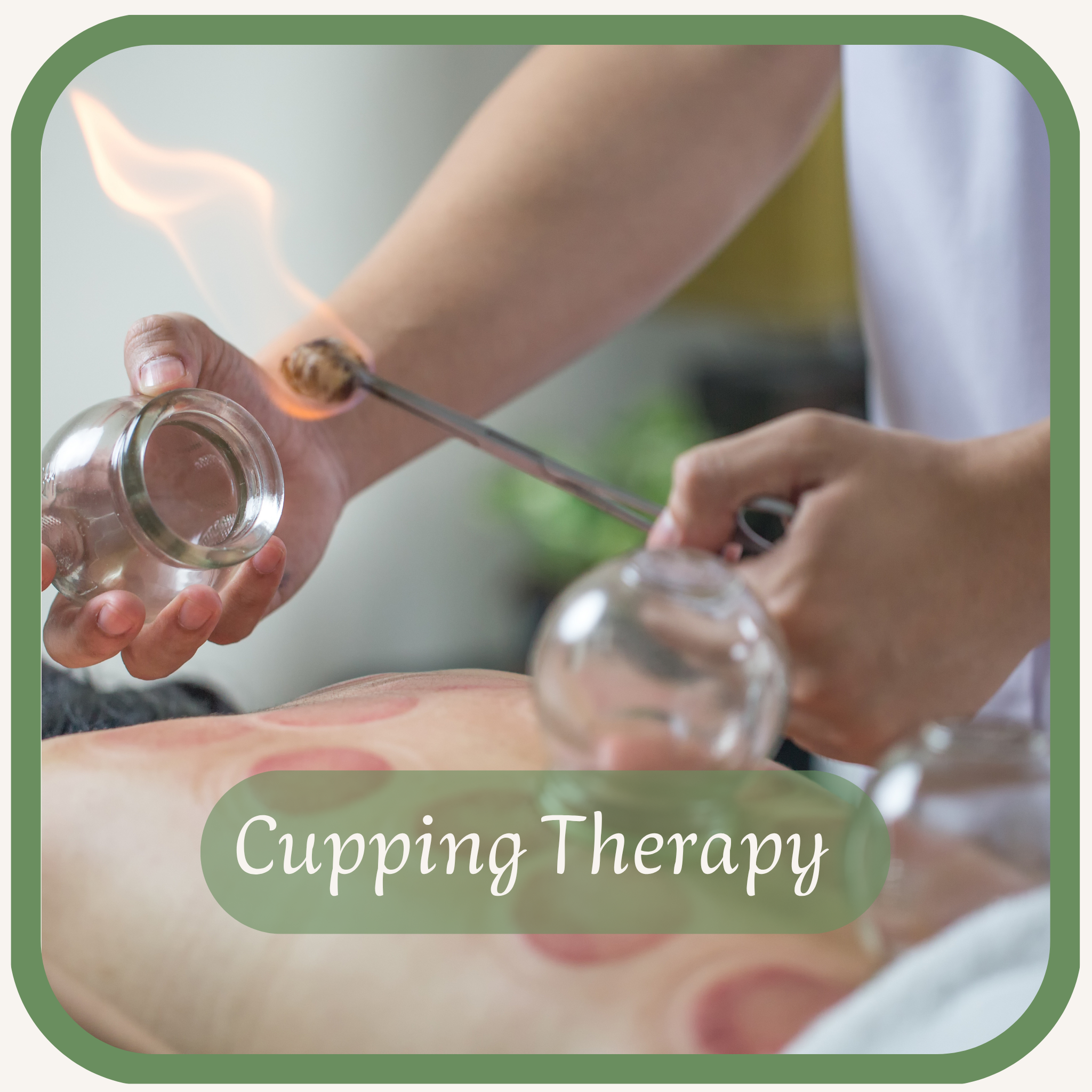 Cupping Therapy
