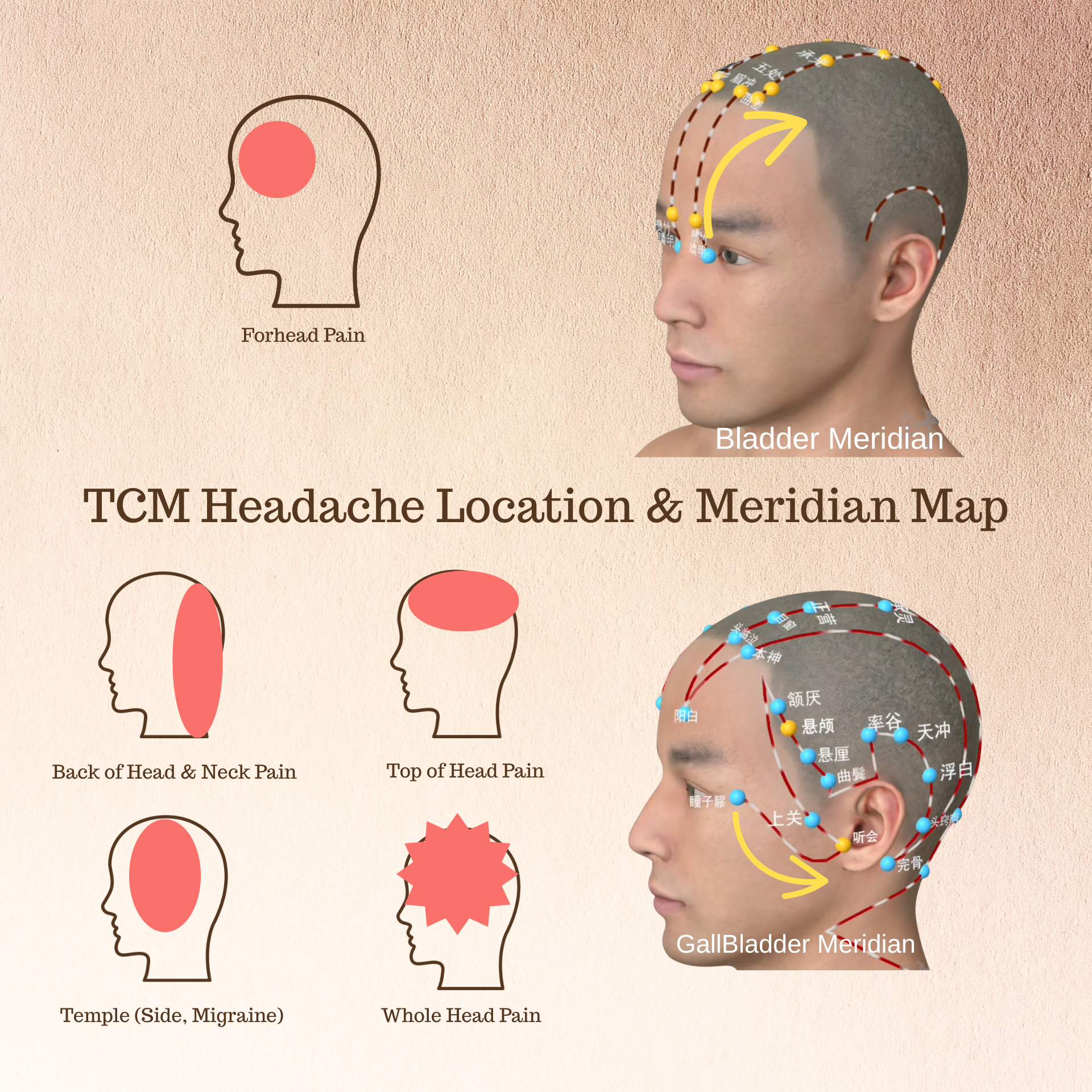 The AcuWood Eye Massager | Targeted Relief for Migraine Eye Pain and Whole Body Pain